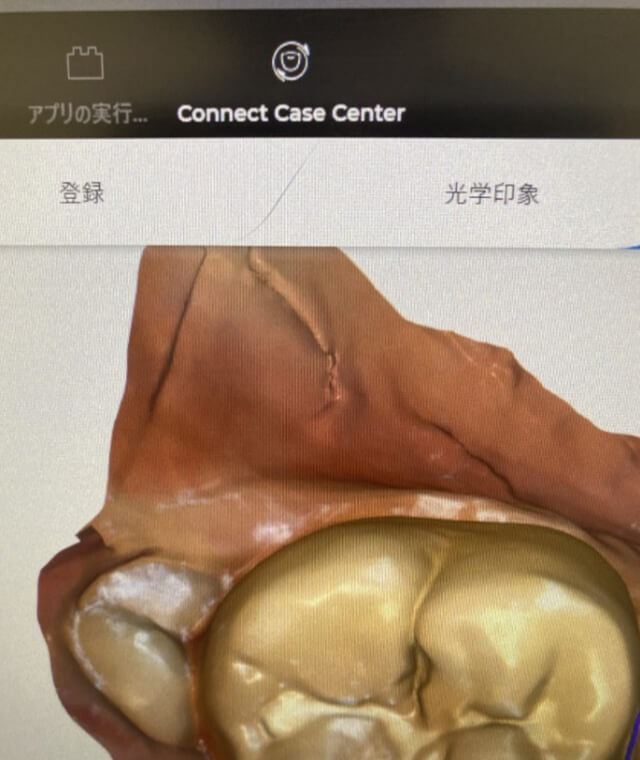 「Connect Case Center Inbox」ログイン